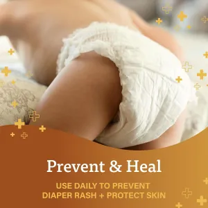 a-d-diaper-rash-ointment