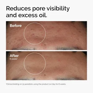 niacinamide-10-zinc-serum
