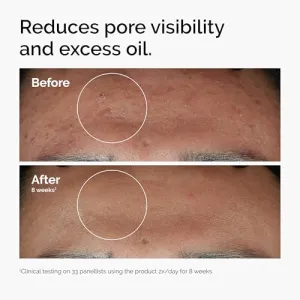 niacinamide-10-zinc-serum