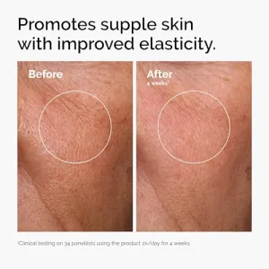 hyaluronic-acid-serum