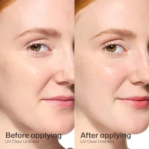 eltamd-uv-clear-sunscreen
