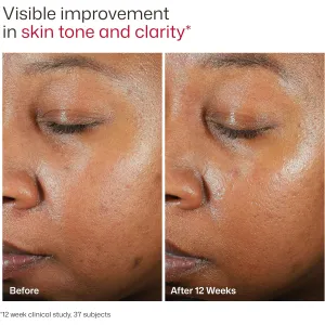 eltamd-uv-clear-sunscreen