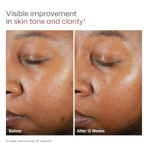eltamd-uv-clear-sunscreen